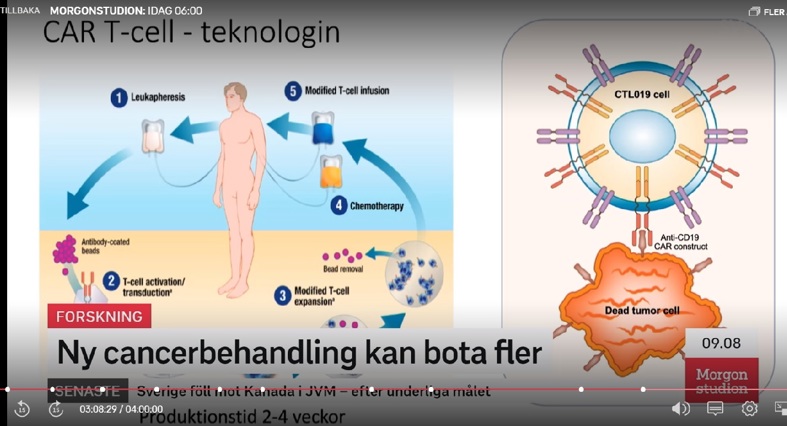 Så funkar CAR-T- illustration SVT